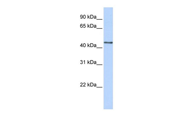B3GNT4 Antibody in Western Blot (WB)