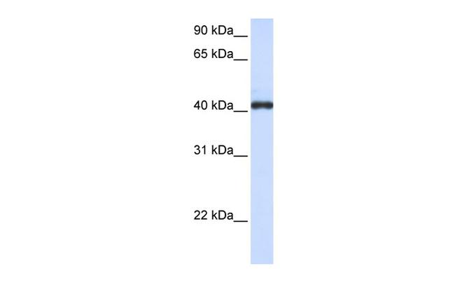 FCRLA Antibody in Western Blot (WB)