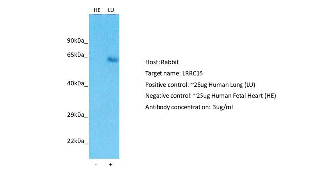 LRRC15 Antibody in Western Blot (WB)