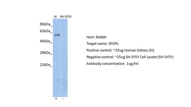 SPOPL Antibody in Western Blot (WB)