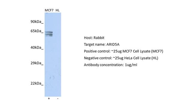 ARID5A Antibody in Western Blot (WB)
