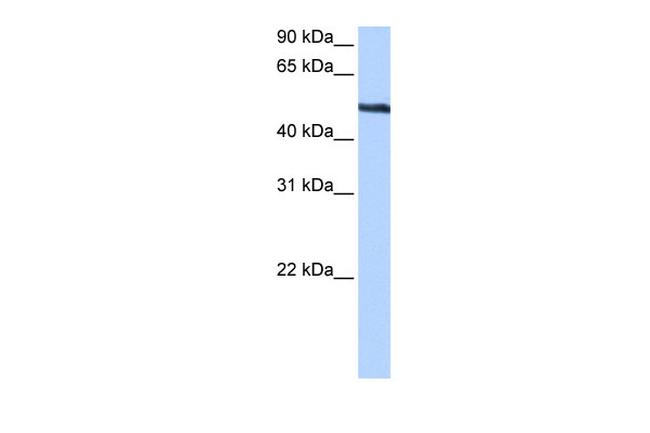 TRIP6 Antibody in Western Blot (WB)