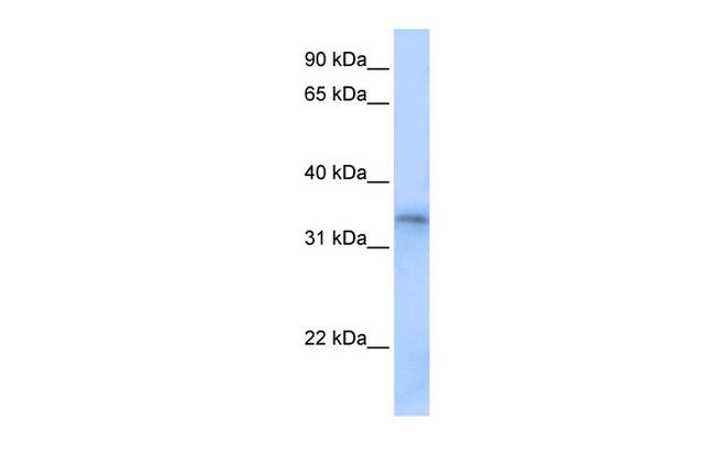 FHL5 Antibody in Western Blot (WB)