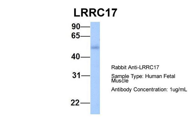 LRRC17 Antibody in Western Blot (WB)