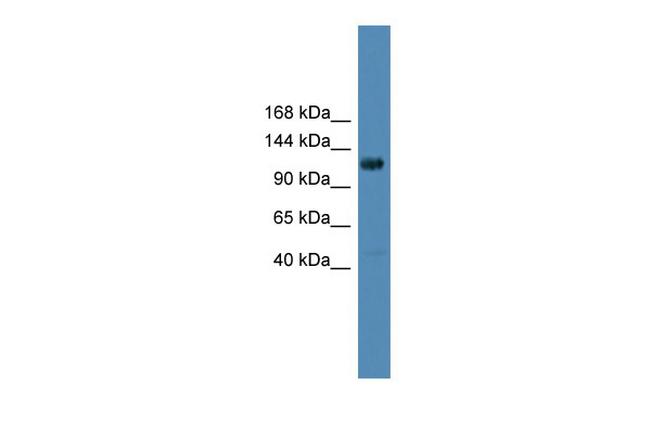 DGKQ Antibody in Western Blot (WB)