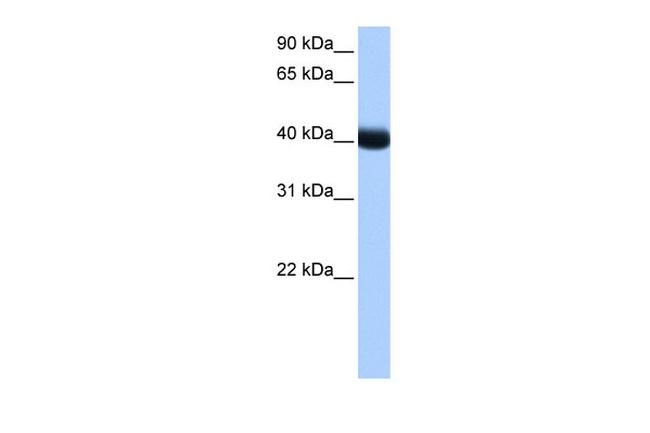 CK1 gamma-3 Antibody in Western Blot (WB)