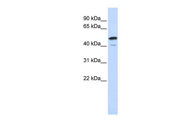 SPATA2L Antibody in Western Blot (WB)