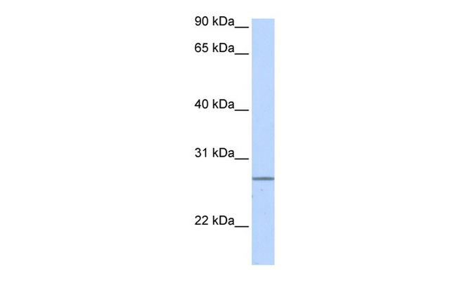 GRPEL2 Antibody in Western Blot (WB)