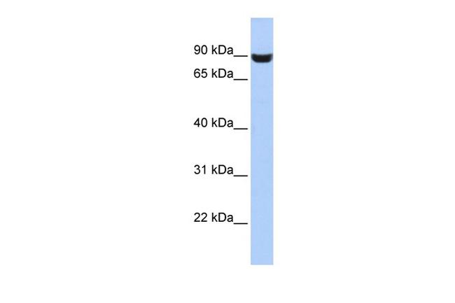 LRFN5 Antibody in Western Blot (WB)