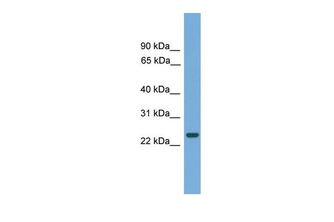 C19orf18 Antibody in Western Blot (WB)