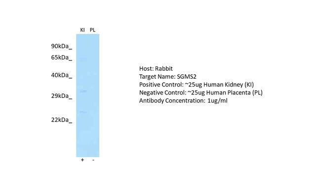 SGMS2 Antibody in Western Blot (WB)
