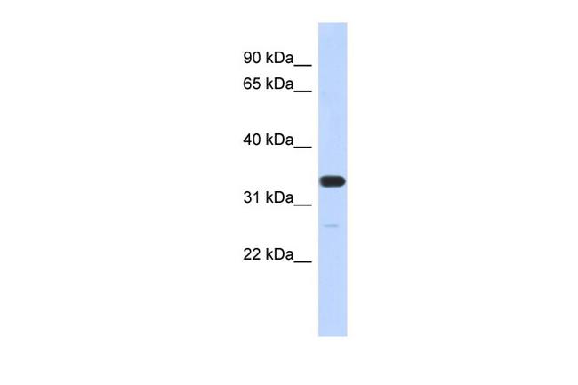 FAM76A Antibody in Western Blot (WB)