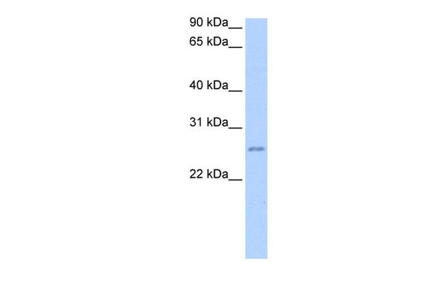 SBSPON Antibody in Western Blot (WB)