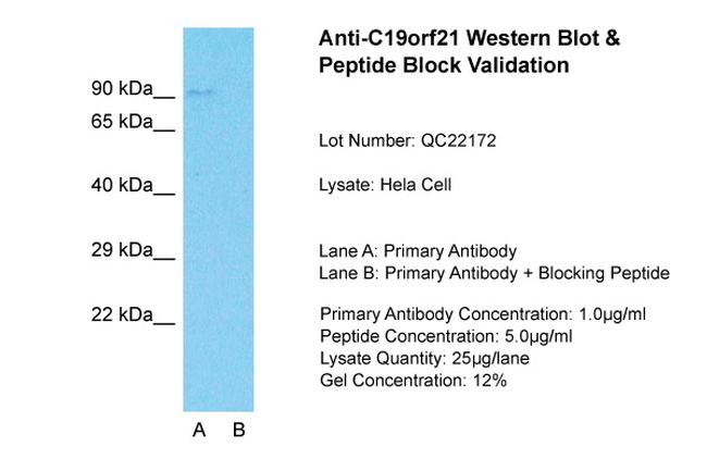 C19orf21 Antibody in Western Blot (WB)