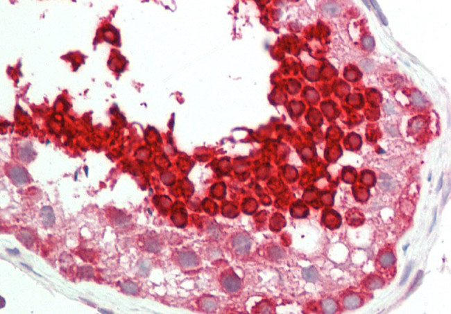 HSP701L Antibody in Immunohistochemistry (Paraffin) (IHC (P))