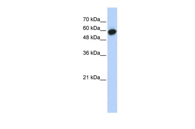 LRRC6 Antibody in Western Blot (WB)