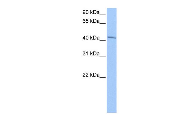 GSG1 Antibody in Western Blot (WB)