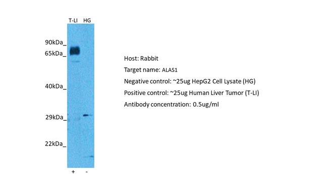 ALAS1 Antibody in Western Blot (WB)