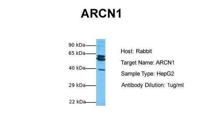 COPD Antibody in Western Blot (WB)