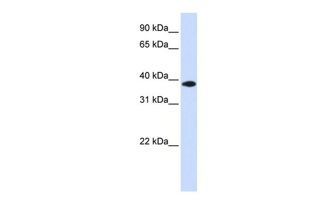 GPD1L Antibody in Western Blot (WB)