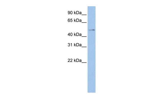 TSPYL4 Antibody in Western Blot (WB)
