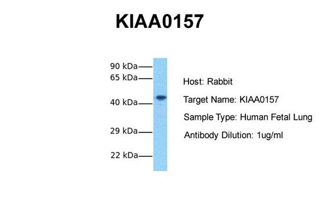 FAM175B Antibody in Western Blot (WB)