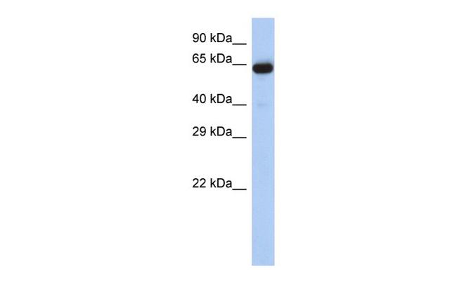 LRRTM1 Antibody in Western Blot (WB)