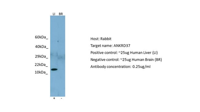 ANKRD37 Antibody in Western Blot (WB)