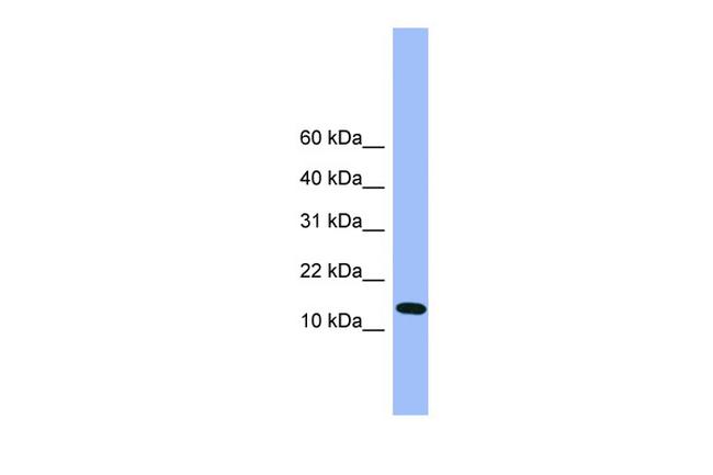 ATP5D Antibody in Western Blot (WB)