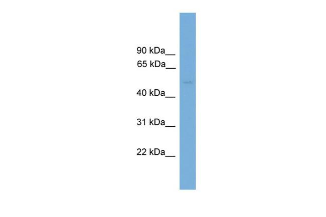 PPP2R5E Antibody in Western Blot (WB)