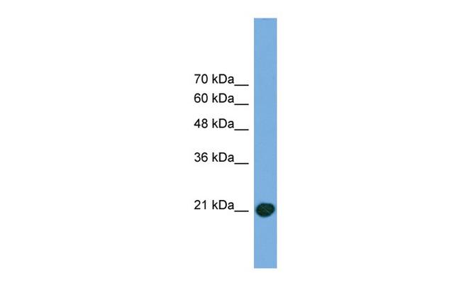 COMMD8 Antibody in Western Blot (WB)