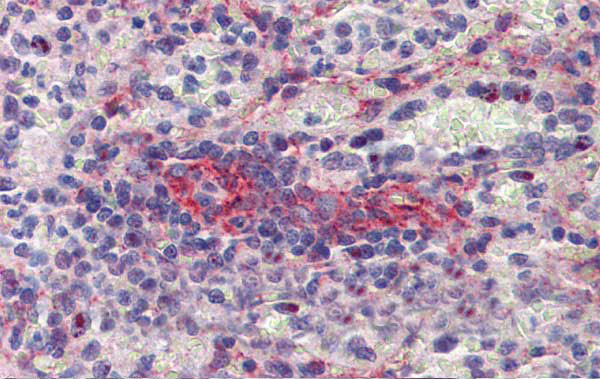 SEPT11 Antibody in Immunohistochemistry (IHC)