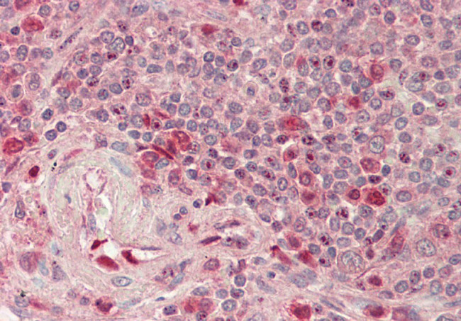 RIOK2 Antibody in Immunohistochemistry (Paraffin) (IHC (P))