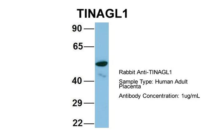 TINAGL1 Antibody in Western Blot (WB)