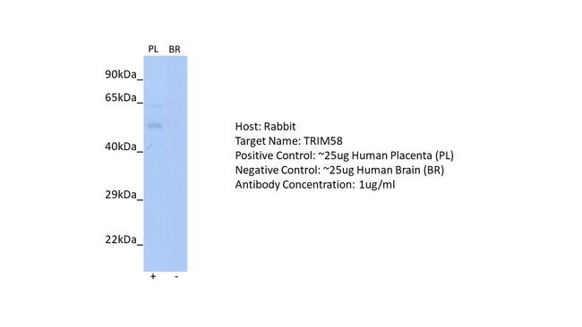 TRIM58 Antibody in Western Blot (WB)