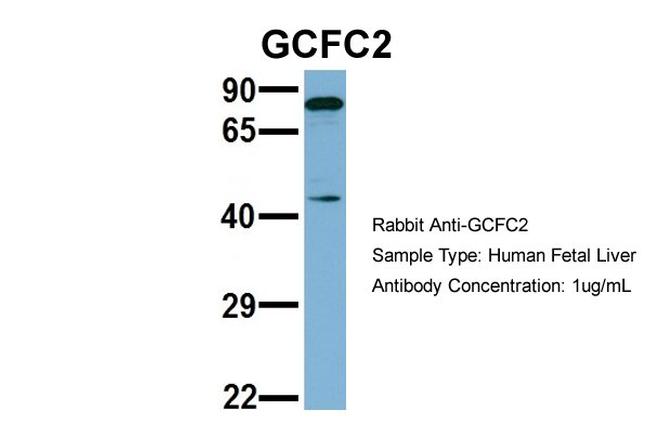 C2orf3 Antibody in Western Blot (WB)