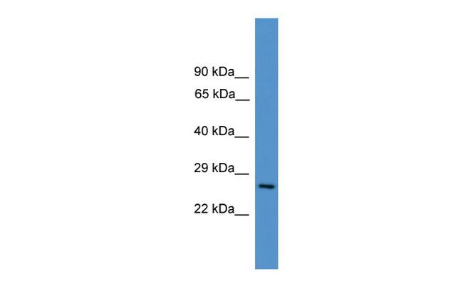 CD8a Antibody in Western Blot (WB)
