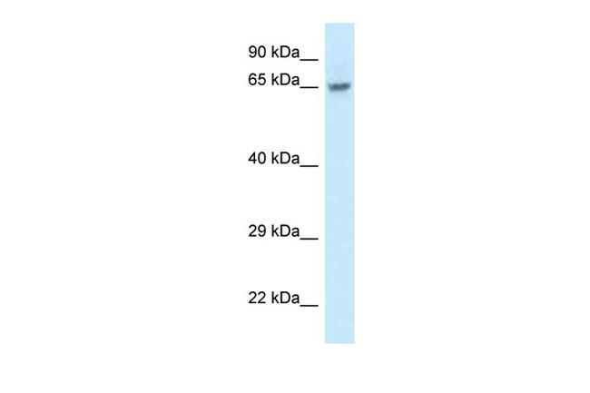 FAM161A Antibody in Western Blot (WB)