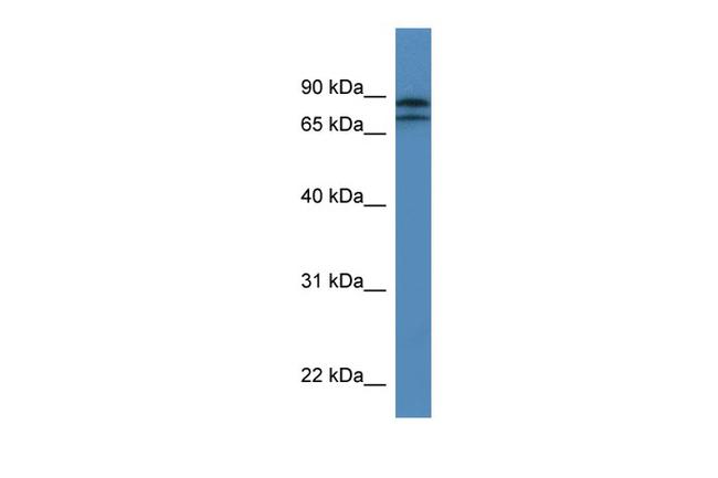KLHL22 Antibody in Western Blot (WB)