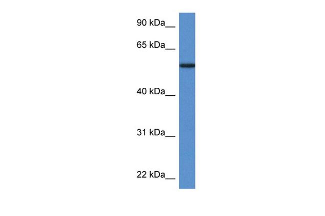 PGM5 Antibody in Western Blot (WB)