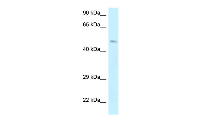 Dematin Antibody in Western Blot (WB)