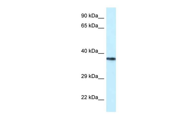 PSTPIP2 Antibody in Western Blot (WB)