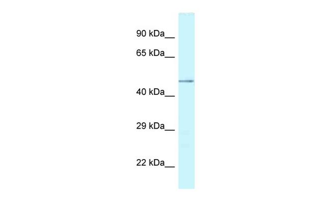 CHI3L2 Antibody in Western Blot (WB)