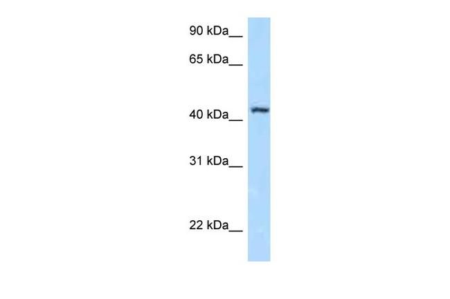 FBXL8 Antibody in Western Blot (WB)