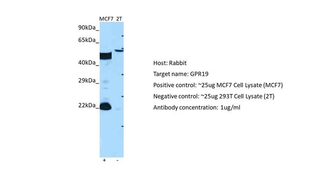 GPR19 Antibody in Western Blot (WB)