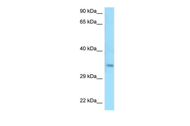 MSANTD3 Antibody in Western Blot (WB)