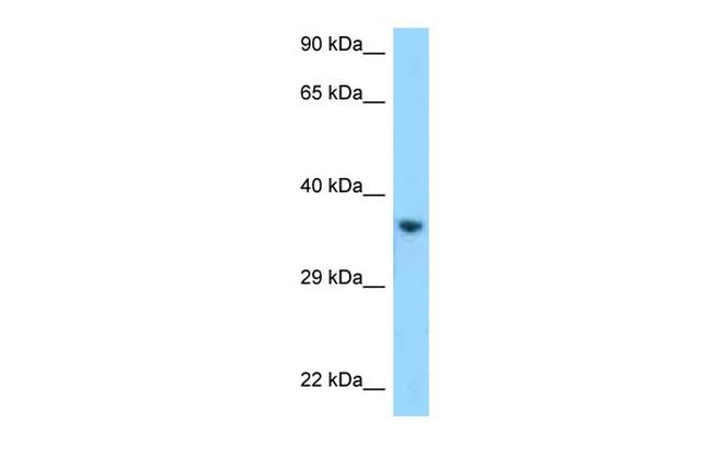 KIR2DL1 Antibody in Western Blot (WB)