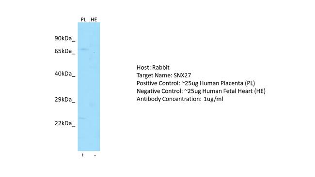 SNX27 Antibody in Western Blot (WB)