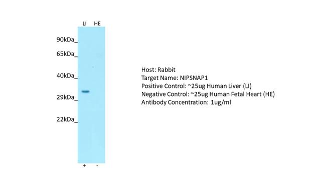 NIPSNAP1 Antibody in Western Blot (WB)