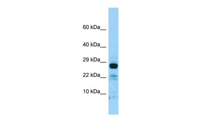 IL22RA2 Antibody in Western Blot (WB)